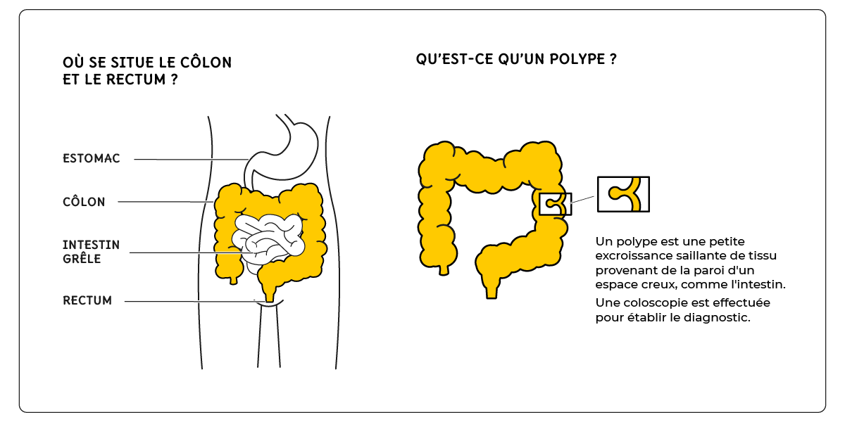 Le dépistage du cancer colorectal | CRCDC Pays de la Loire